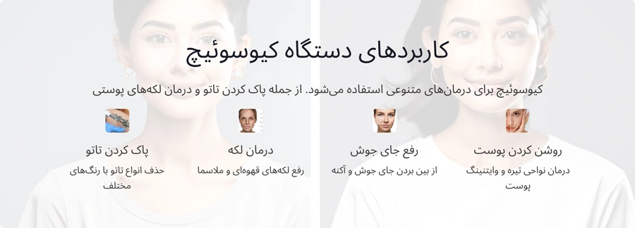 کاربرد دستگاه لیزر کیوسوئیچ