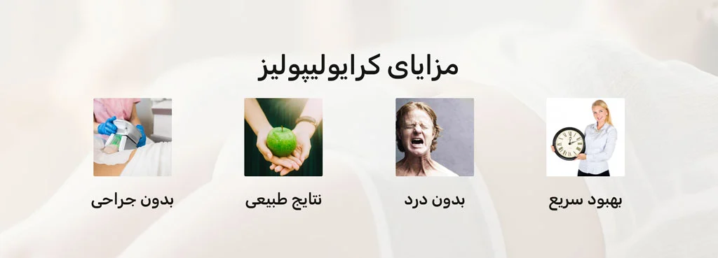 مزایای کرایولیپولیز