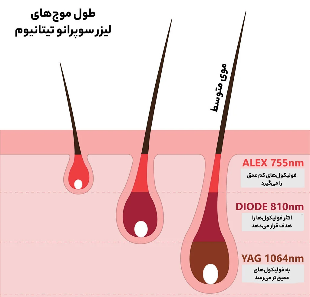 طول موج لیزر سوپرانو تیتانیوم